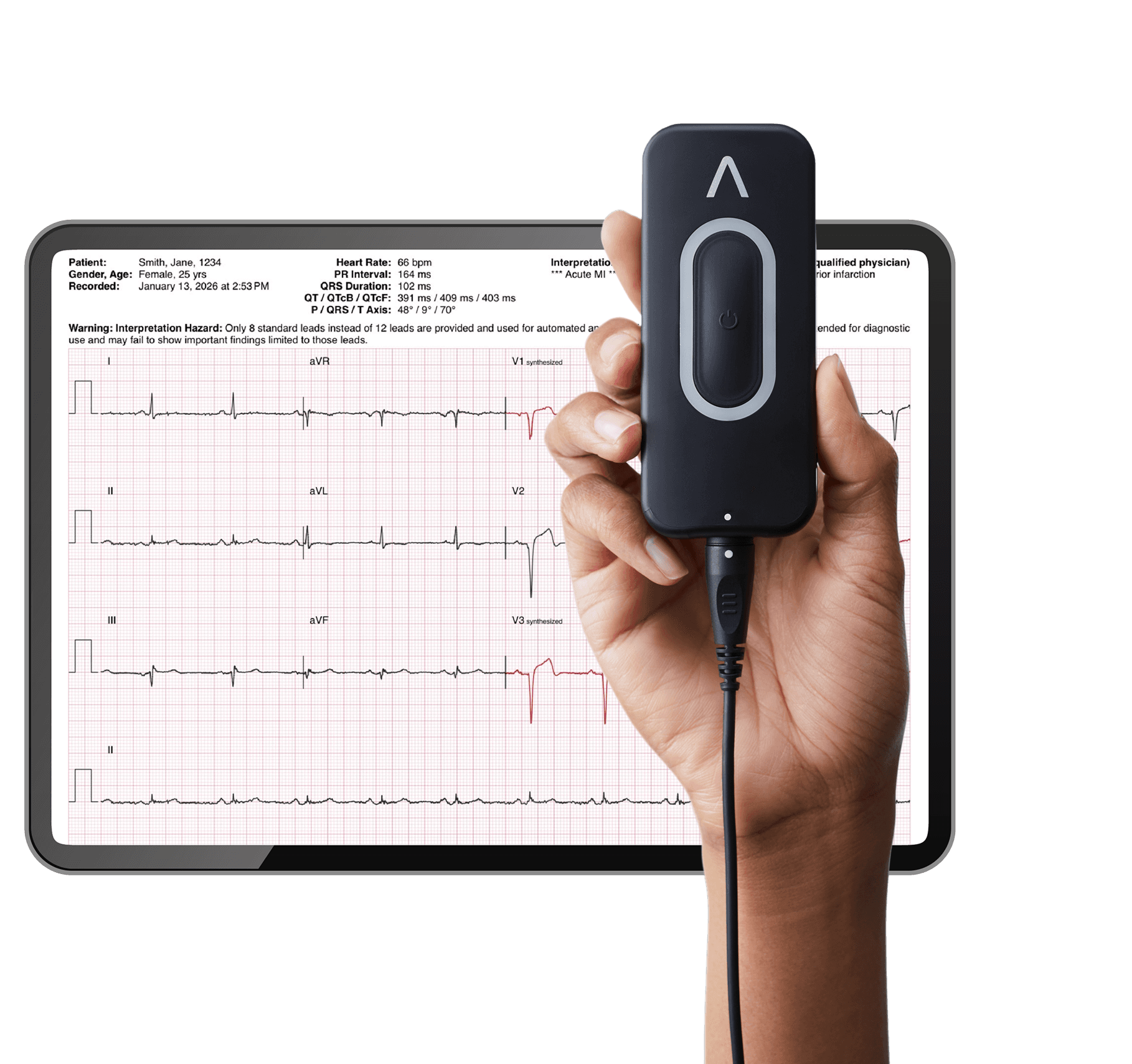 Kardia 12L Device